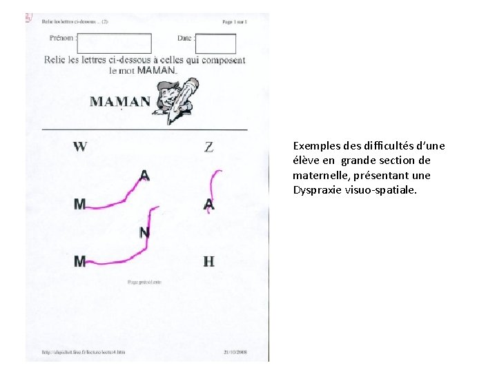Exemples difficultés d’une élève en grande section de maternelle, présentant une Dyspraxie visuo-spatiale. Exemples difficultés d’une élève en grande section de maternelle, présentant une Dyspraxie visuo-spatiale.