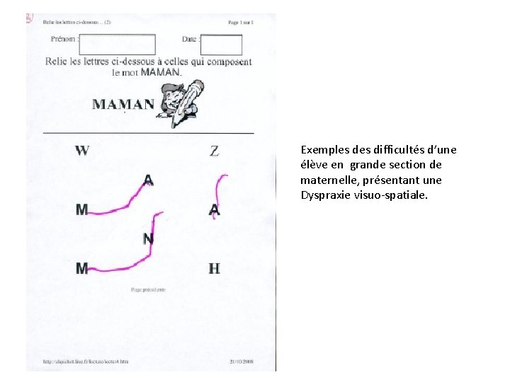 Exemples difficultés d’une élève en grande section de maternelle, présentant une Dyspraxie visuo-spatiale. 