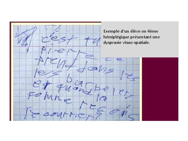 Exemple d’un élève en 4ème hémiplégique présentant une dyspraxie visuo-spatiale. Exemple d’un élève en 4ème hémiplégique présentant une dyspraxie visuo-spatiale.