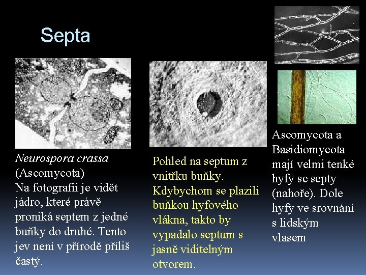 Septa Neurospora crassa (Ascomycota) Na fotografii je vidět jádro, které právě proniká septem z