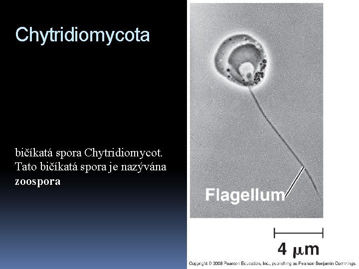 Chytridiomycota bičíkatá spora Chytridiomycot. Tato bičíkatá spora je nazývána zoospora 