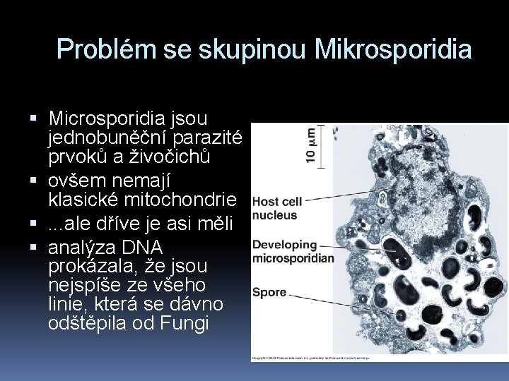 Problém se skupinou Mikrosporidia Microsporidia jsou jednobuněční parazité prvoků a živočichů ovšem nemají klasické