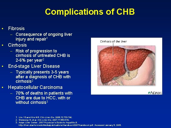 Complications of CHB • Fibrosis – Consequence of ongoing liver injury and repair 1