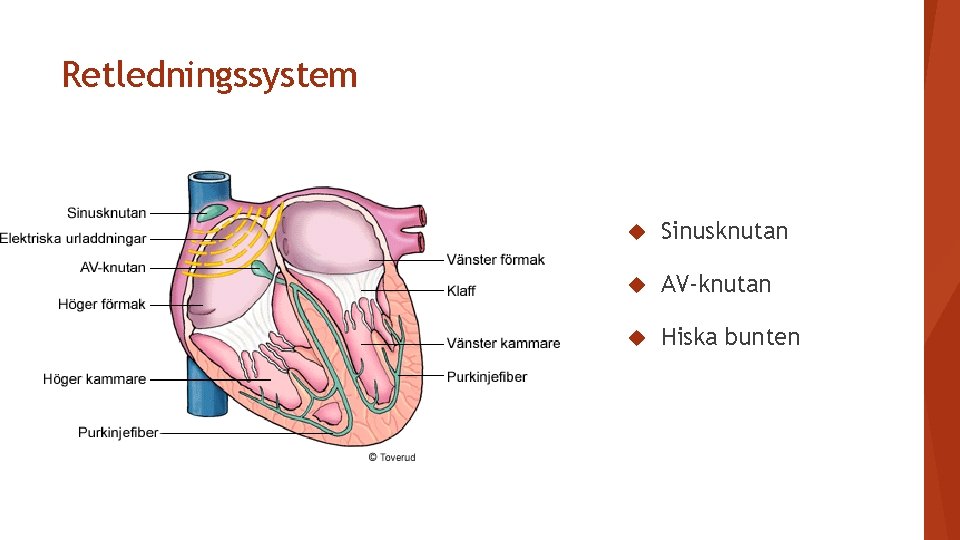 Retledningssystem Sinusknutan AV-knutan Hiska bunten 