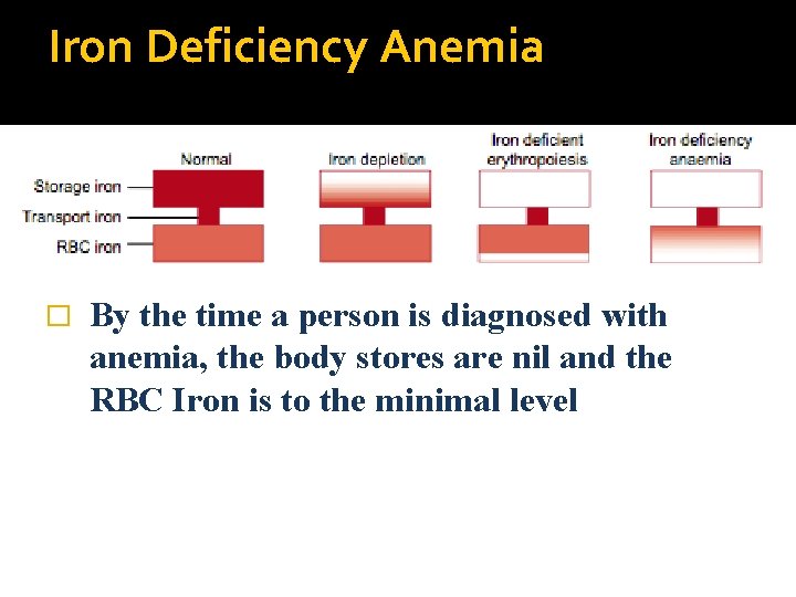 Iron Deficiency Anemia � By the time a person is diagnosed with anemia, the