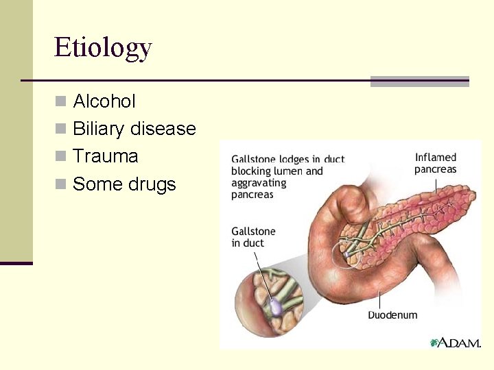 Etiology n Alcohol n Biliary disease n Trauma n Some drugs 