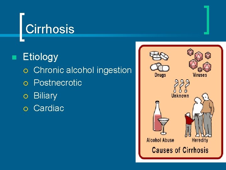 Cirrhosis n Etiology ¡ ¡ Chronic alcohol ingestion Postnecrotic Biliary Cardiac 