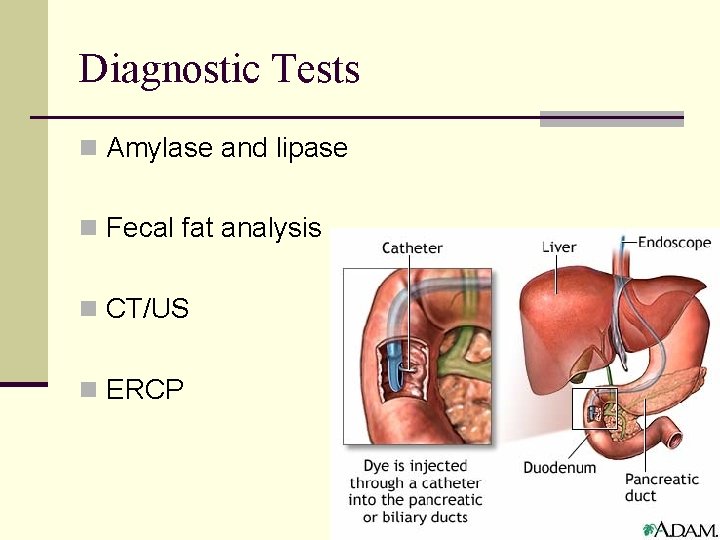 Diagnostic Tests n Amylase and lipase n Fecal fat analysis n CT/US n ERCP