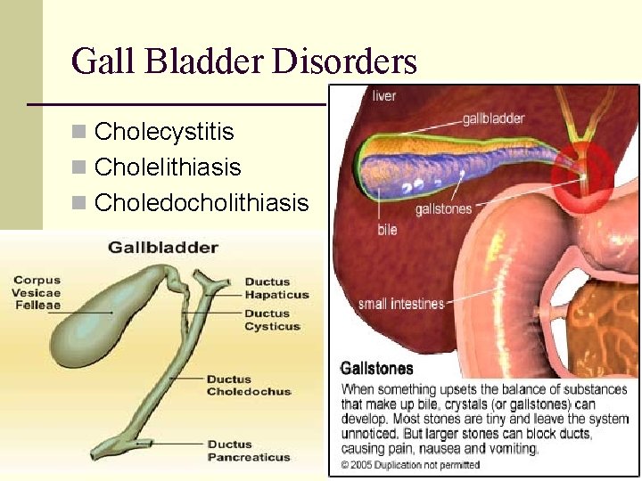 Gall Bladder Disorders n Cholecystitis n Cholelithiasis n Choledocholithiasis 