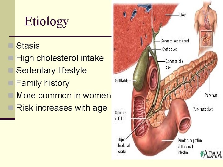 Etiology n Stasis n High cholesterol intake n Sedentary lifestyle n Family history n