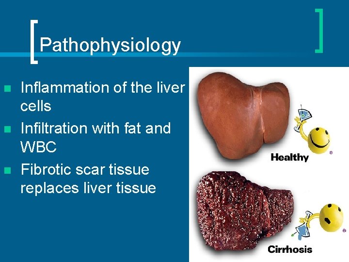 Pathophysiology n n n Inflammation of the liver cells Infiltration with fat and WBC