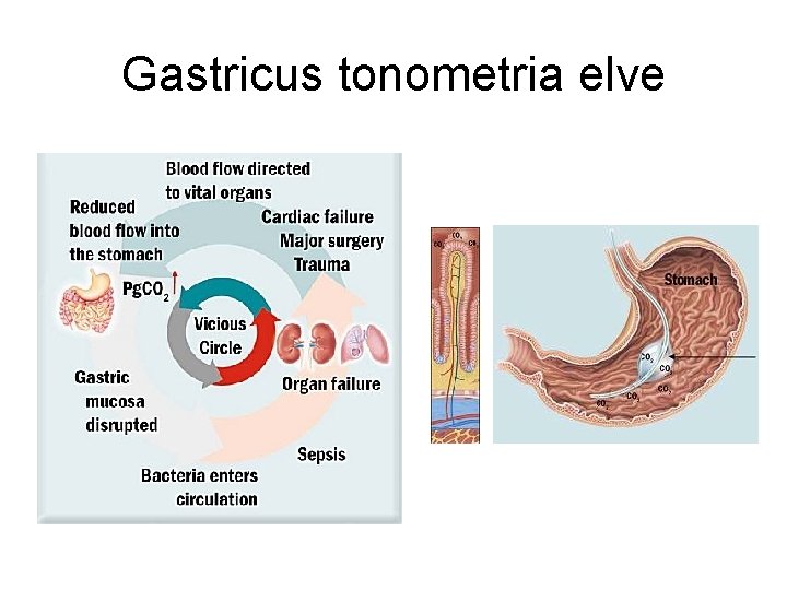 Gastricus tonometria elve 