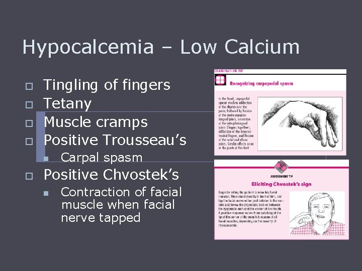 Hypocalcemia – Low Calcium o o Tingling of fingers Tetany Muscle cramps Positive Trousseau’s