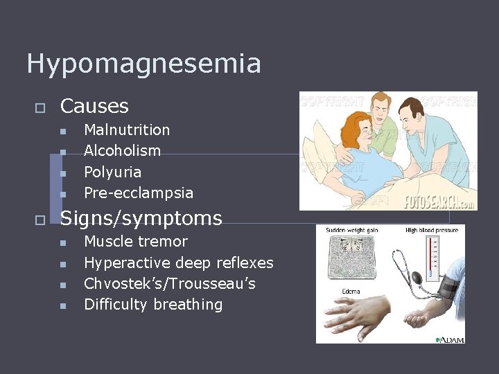 Hypomagnesemia o Causes n n o Malnutrition Alcoholism Polyuria Pre-ecclampsia Signs/symptoms n n Muscle