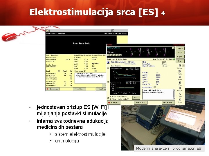 Elektrostimulacija srca [ES] • • 4 jednostavan pristup ES [Wi Fi] i mijenjanje postavki