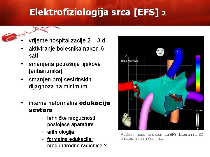 Elektrofiziologija srca [EFS] 2 • vrijeme hospitalizacije 2 – 3 d • aktiviranje bolesnika