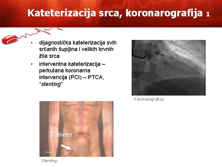 Kateterizacija srca, koronarografija • • dijagnostička kateterizacija svih srčanih šupljina i velikih krvnih žila