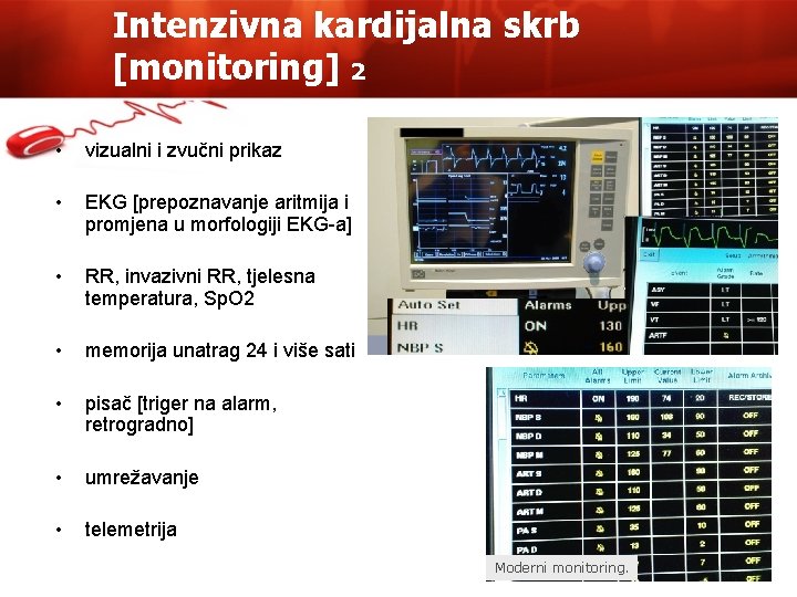 Intenzivna kardijalna skrb [monitoring] 2 • vizualni i zvučni prikaz • EKG [prepoznavanje aritmija