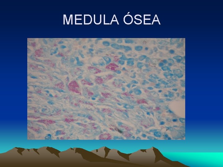 MEDULA ÓSEA 