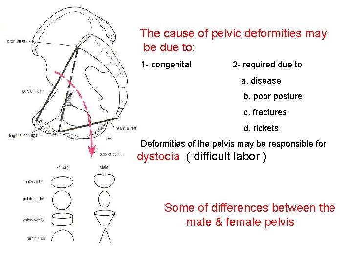 The cause of pelvic deformities may be due to: 1 - congenital 2 -
