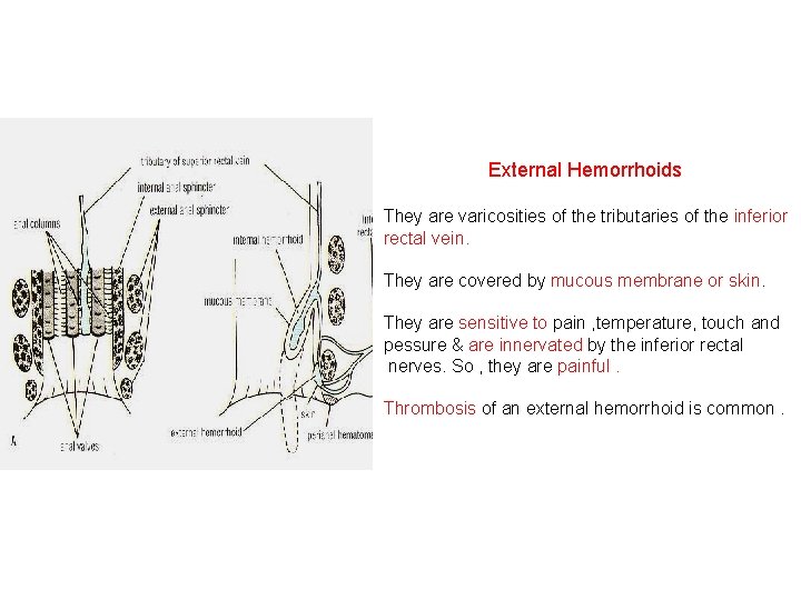 External Hemorrhoids They are varicosities of the tributaries of the inferior rectal vein. They