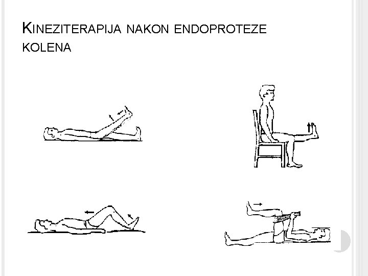 KINEZITERAPIJA NAKON ENDOPROTEZE KOLENA 