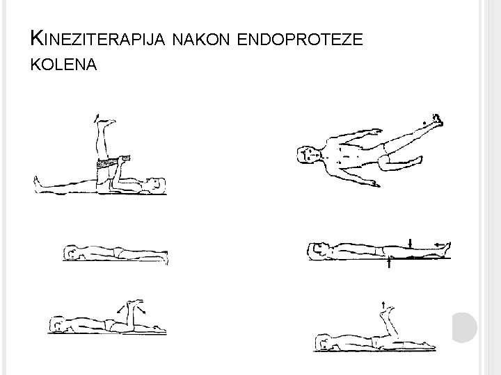 KINEZITERAPIJA NAKON ENDOPROTEZE KOLENA 