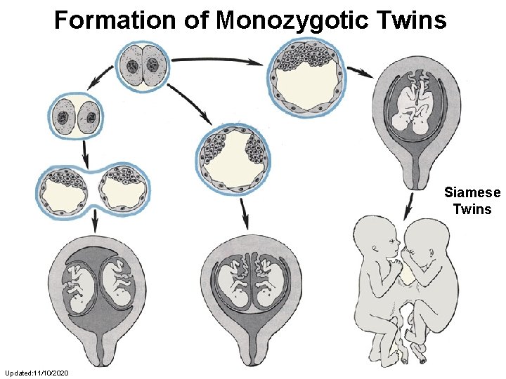 Formation of Monozygotic Twins Siamese Twins Updated: 11/10/2020 