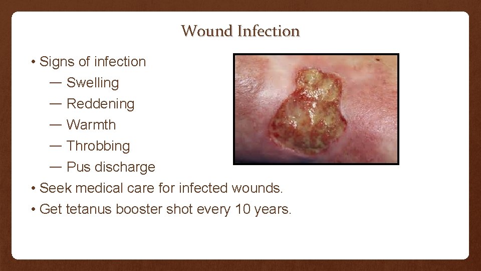 Wound Infection • Signs of infection — Swelling — Reddening — Warmth — Throbbing