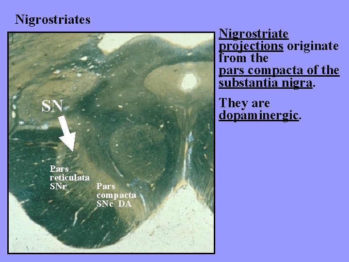 Nigrostriates SN Pars reticulata Pars SNr compacta SNc DA Nigrostriate projections originate from the