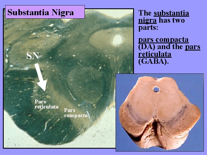 Substantia Nigra pars compacta (DA) and the pars reticulata (GABA). SN Pars reticulata The