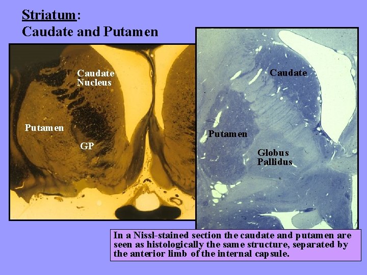 Striatum: Caudate and Putamen Caudate Nucleus Putamen GP Globus Pallidus In a Nissl-stained section