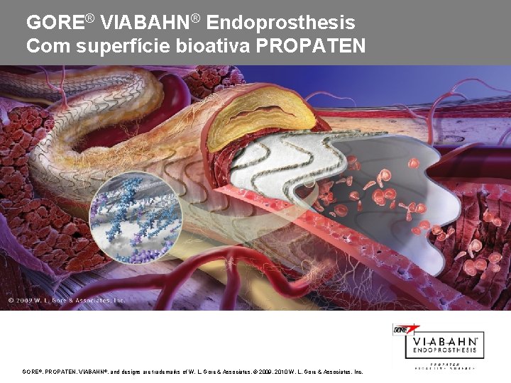 GORE® VIABAHN® Endoprosthesis Com superfície bioativa PROPATEN GORE, VIABAHN ®, and designs are trademarks