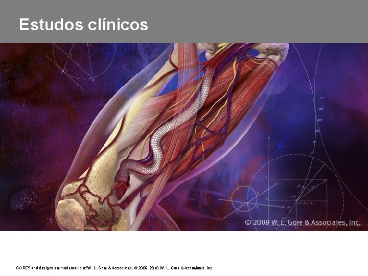 Estudos clínicos GORE, VIABAHN ®, and designs are trademarks of W. L. Gore &