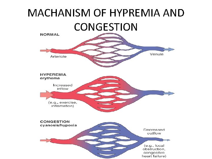 MACHANISM OF HYPREMIA AND CONGESTION 