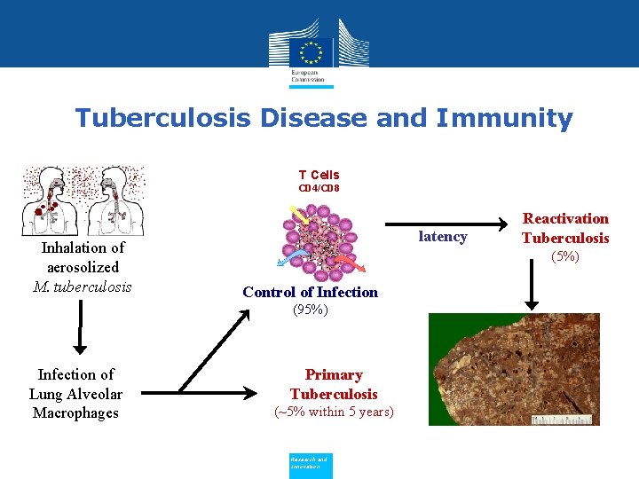 Tuberculosis Disease and Immunity T Cells Chemokines CD 4/CD 8 Inhalation of aerosolized M.