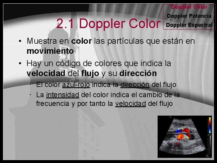Doppler Color 2. 1 Doppler Color Doppler Potencia Doppler Espectral • Muestra en color