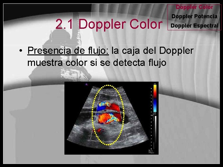 Doppler Color 2. 1 Doppler Color Doppler Potencia Doppler Espectral • Presencia de flujo: