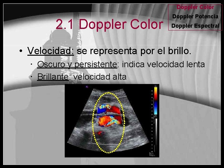 Doppler Color 2. 1 Doppler Color Doppler Potencia Doppler Espectral • Velocidad: se representa