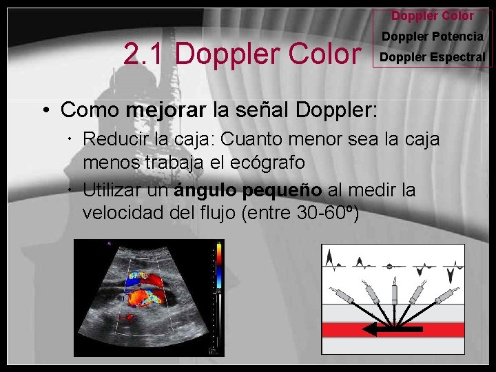 Doppler Color 2. 1 Doppler Color Doppler Potencia Doppler Espectral • Como mejorar la