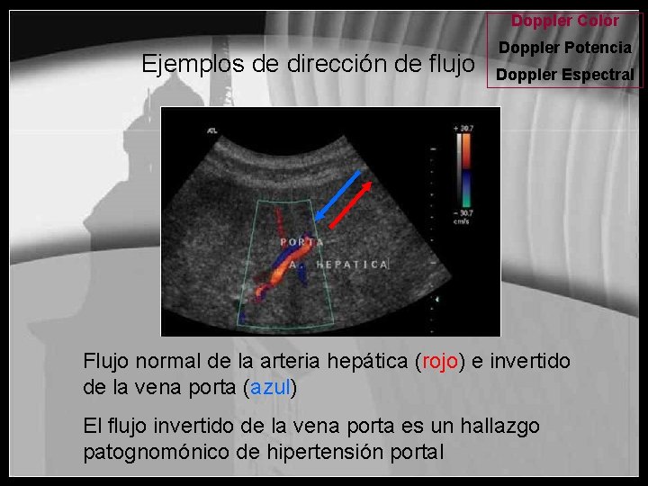 Doppler Color Ejemplos de dirección de flujo Doppler Potencia Doppler Espectral Flujo normal de