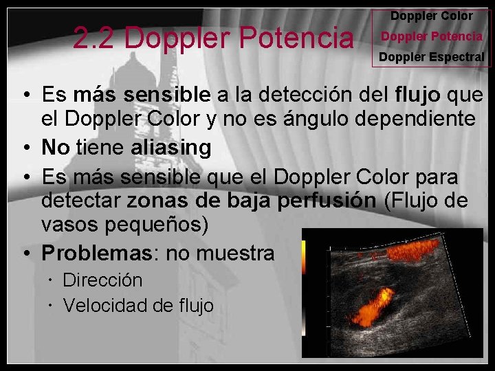 2. 2 Doppler Potencia Doppler Color Doppler Potencia Doppler Espectral • Es más sensible