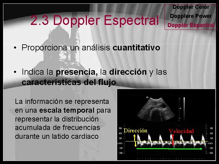 Doppler Color 2. 3 Doppler Espectral Dopplere Power Doppler Espectral • Proporciona un análisis
