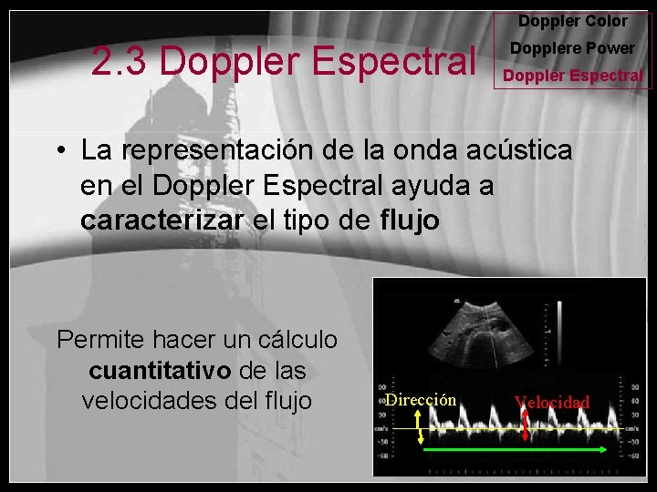 Doppler Color 2. 3 Doppler Espectral Dopplere Power Doppler Espectral • La representación de