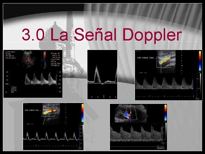 3. 0 La Señal Doppler 