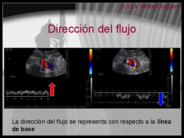 3. 0 La Señal Doppler Dirección del flujo La dirección del flujo se representa
