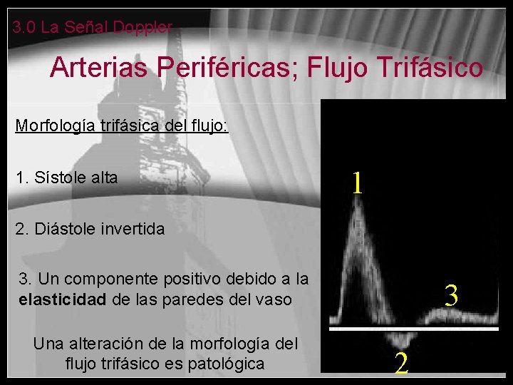 3. 0 La Señal Doppler Arterias Periféricas; Flujo Trifásico Morfología trifásica del flujo: 1.