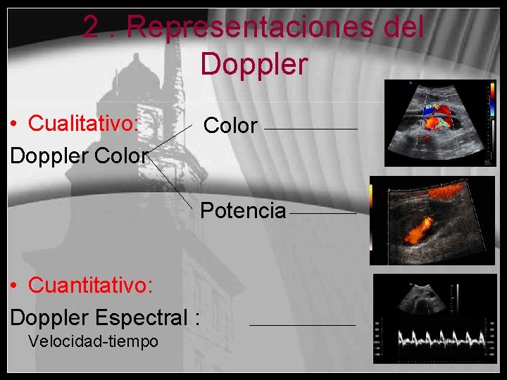 2. Representaciones del Doppler • Cualitativo: Doppler Color Potencia • Cuantitativo: Doppler Espectral :