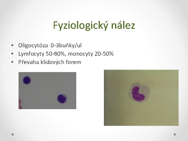 Fyziologický nález • Oligocytóza 0 -3 buňky/ul • Lymfocyty 50 -80%, monocyty 20 -50%
