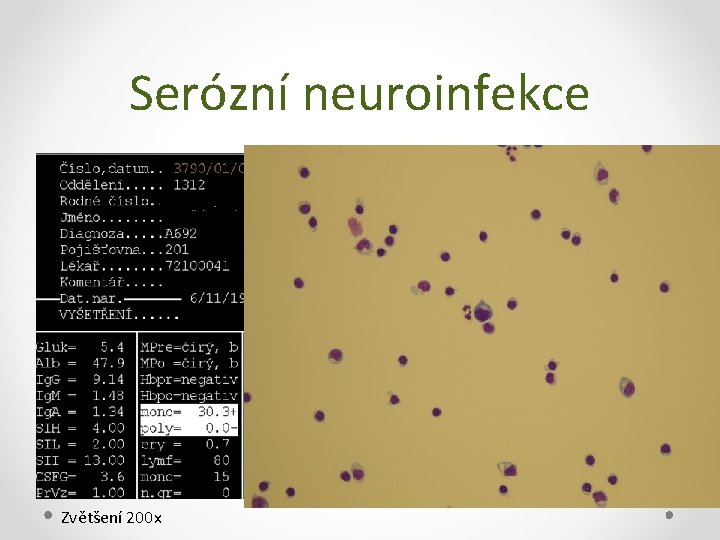 Serózní neuroinfekce Zvětšení 200 x 
